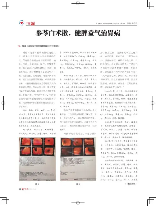 参苓白术散,健脾益气治胃病