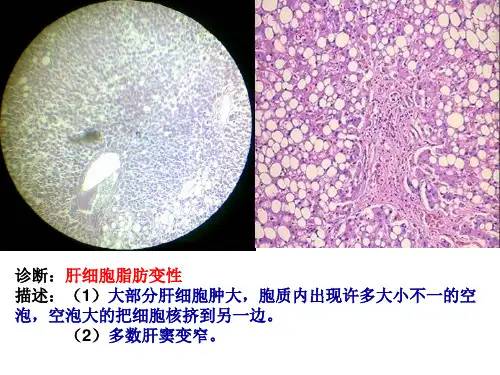 病理学切片考试