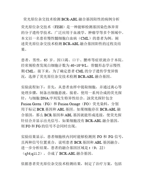 荧光原位杂交技术检测BCR-ABL融合基因阳性的病例分析