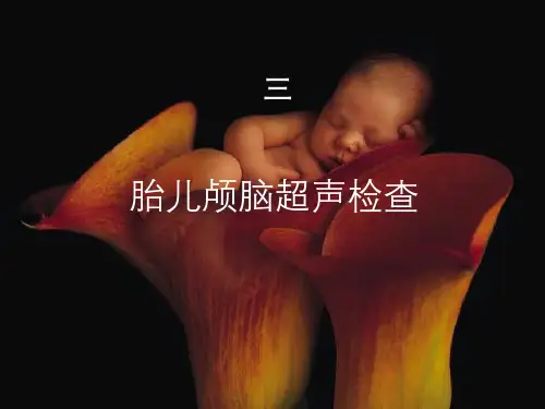 胎儿颅脑超声检查(三)