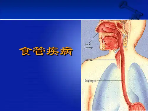 食管疾病ppt课件