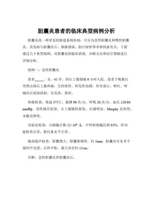 胆囊炎患者的临床典型病例分析