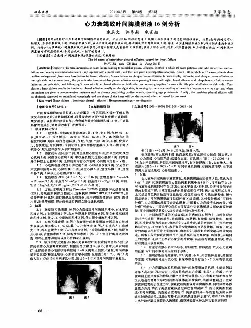 心力衰竭致叶间胸膜积液16例分析
