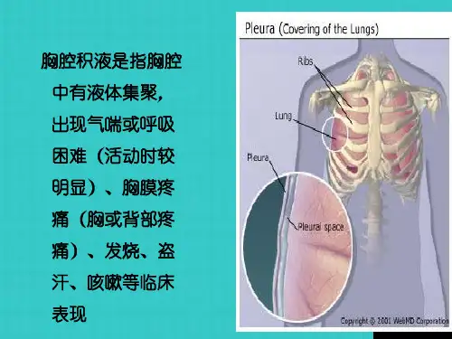 呼吸内科教学查房胸腔积液