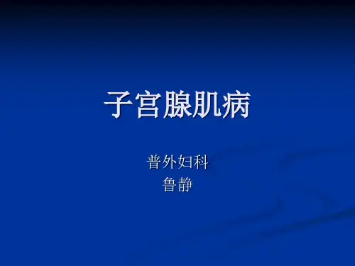 子宫腺肌症2