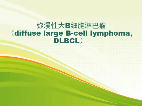 弥漫性大B细胞淋巴瘤病理 