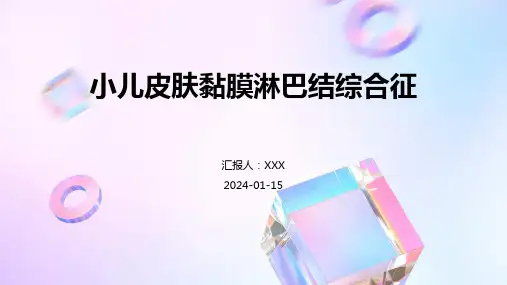 小儿皮肤黏膜淋巴结综合征疾病PPT演示课件