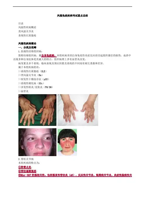 风湿免疫疾病考试重点总结