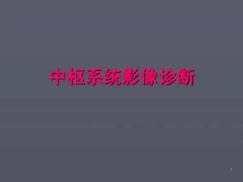中枢系统影像诊断ppt课件
