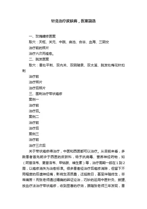 针灸治疗皮肤病，医案简选