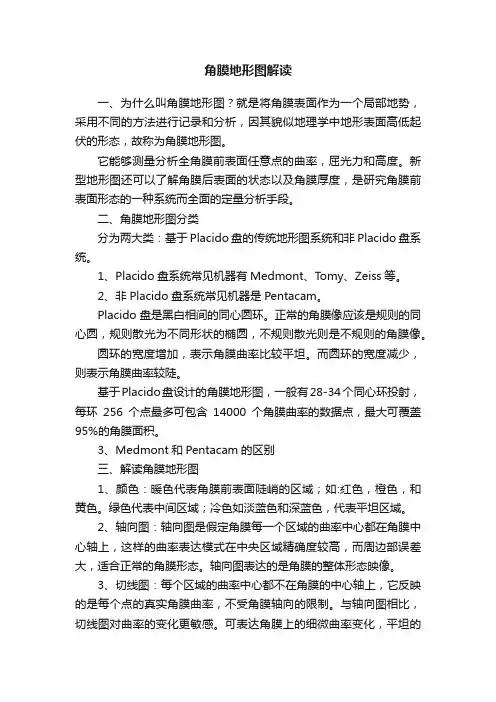 角膜地形图解读