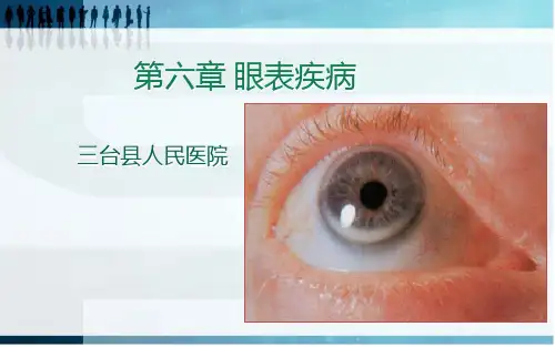 第6章+眼表疾病