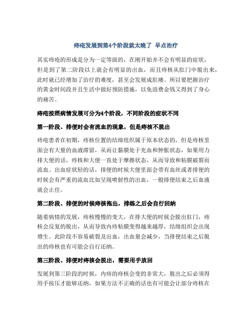 痔疮发展到第4个阶段就太晚了 早点治疗