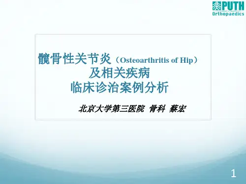 髋骨关节炎临床诊治病例
