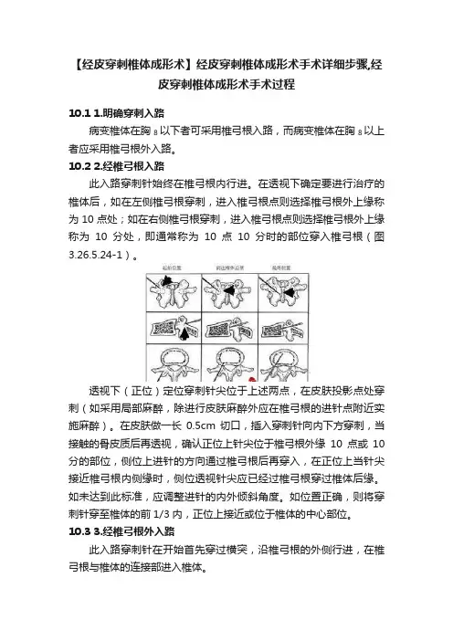 【经皮穿刺椎体成形术】经皮穿刺椎体成形术手术详细步骤,经皮穿刺椎体成形术手术过程