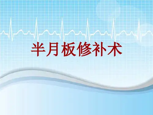手术讲解模板：半月板修补术