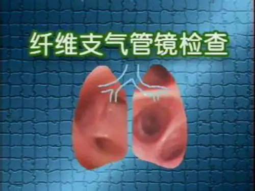 纤维支气管镜