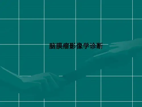 脑膜瘤影像学诊断