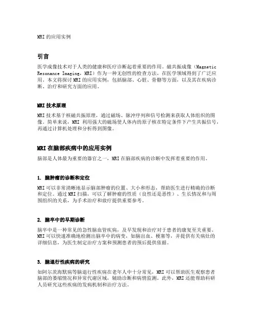 mri的应用实例