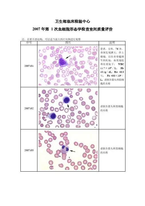 2007-2015年卫生部血细胞形态学检查室间质量评价
