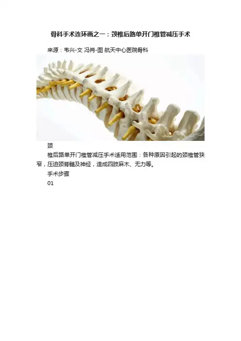 骨科手术连环画之一：颈椎后路单开门椎管减压手术