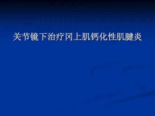 冈上肌钙化性肌腱炎