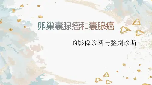 卵巢囊腺瘤和囊腺癌的影像诊断与鉴别诊断
