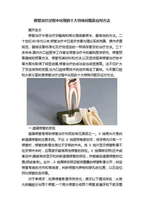 根管治疗过程中出现的十大特殊问题及应对方法