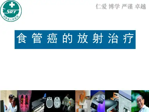食管癌的放射治疗2019.12