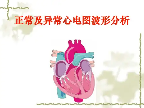 正常及异常心电图波形分析 ppt课件