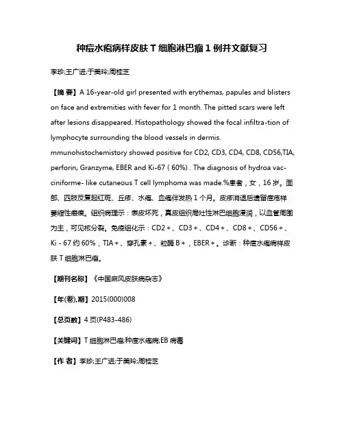 种痘水疱病样皮肤T细胞淋巴瘤1例并文献复习
