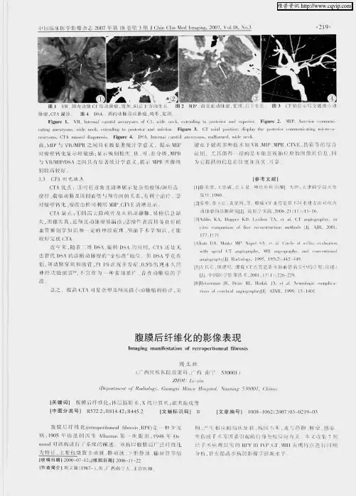 腹膜后纤维化的影像表现
