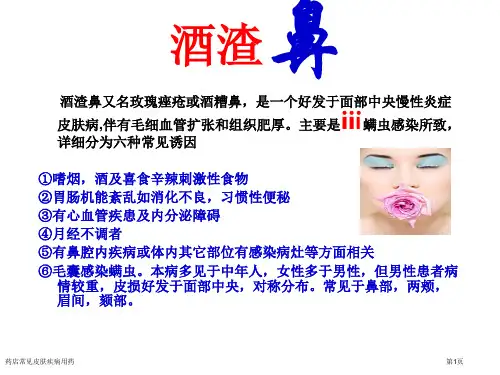 药店常见皮肤疾病用药