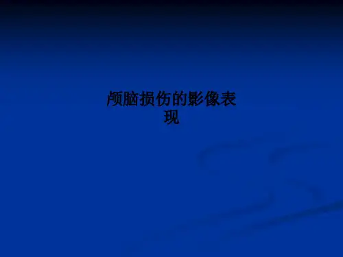 颅脑损伤的影像表现