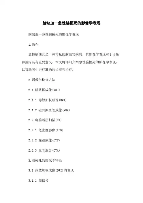脑缺血—急性脑梗死的影像学表现
