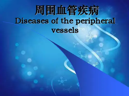 周围血管与淋巴管疾病