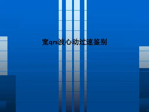 宽qrs波心动过速鉴别