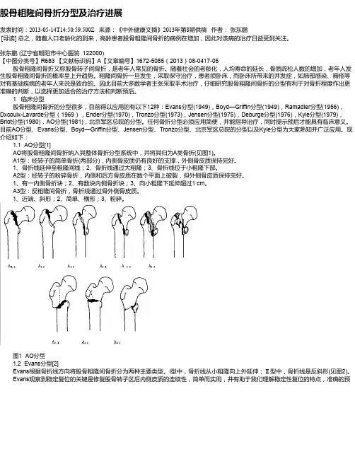股骨粗隆间骨折分型及治疗进展