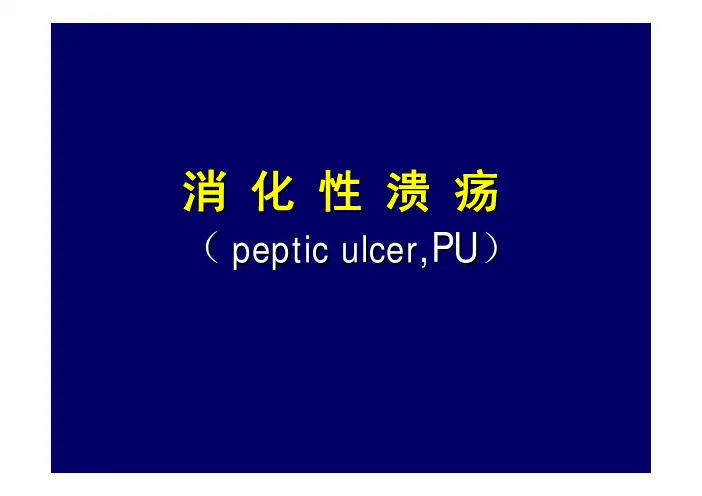内科学PPT课件 消化性溃疡 消化系统疾病