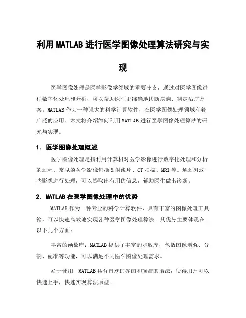 利用MATLAB进行医学图像处理算法研究与实现