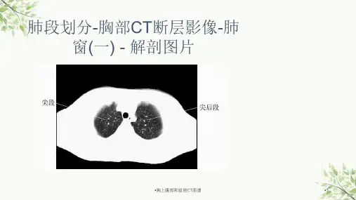 胸上腹部和盆腔CT图谱课件