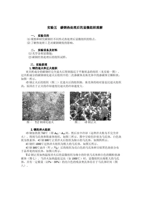 实验五 碳钢热处理后的显微组织观察[1]