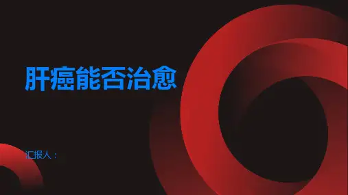 肝癌能治愈吗