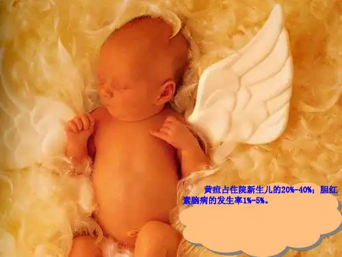 新生儿黄疸专题知识宣教培训课件