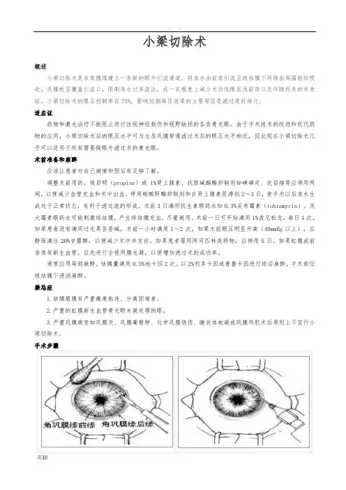小梁切除术