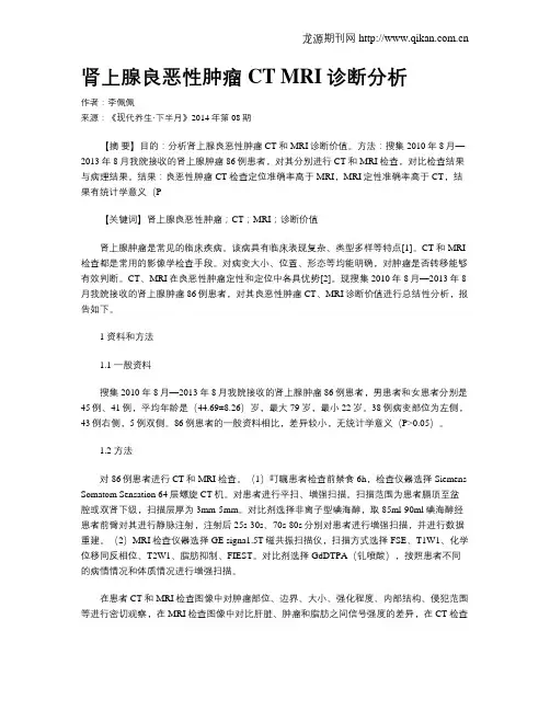 肾上腺良恶性肿瘤CT MRI诊断分析