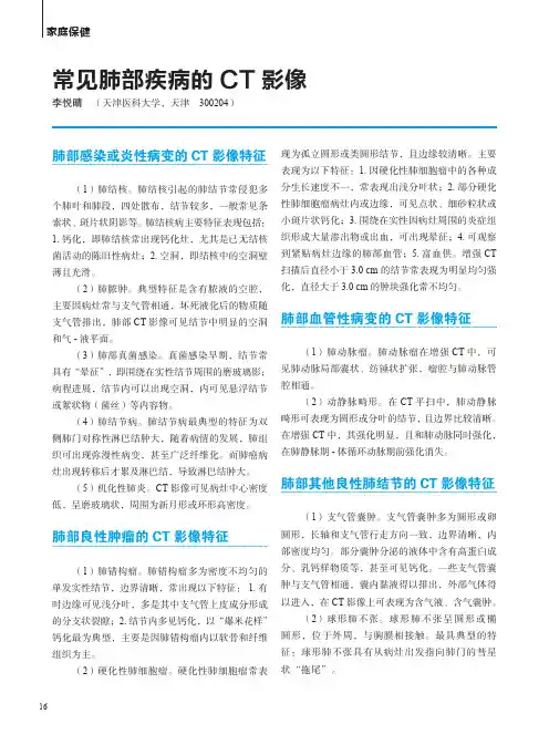 常见肺部疾病的CT影像