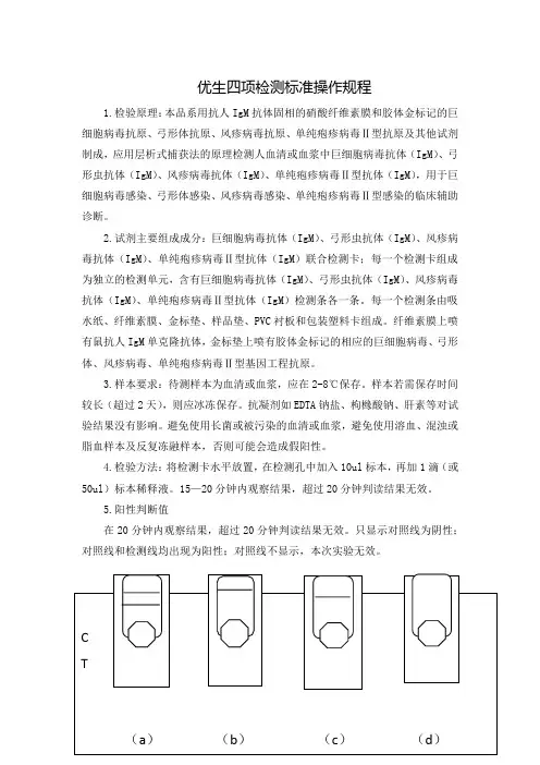 优生四项检测标准操作规程