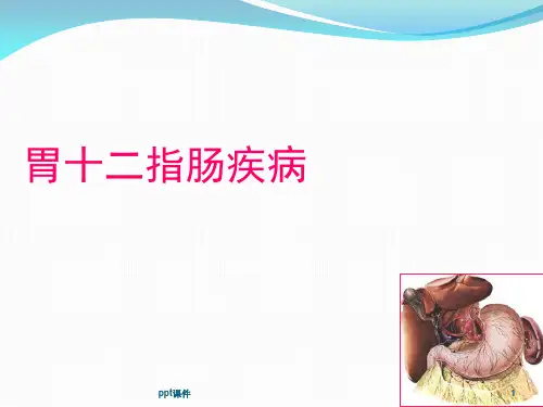 胃十二指肠溃疡  ppt课件