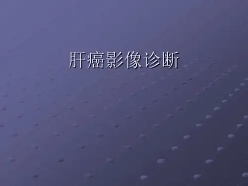 肝癌影像诊断ppt课件